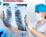 Результаты флюорографии готовы!